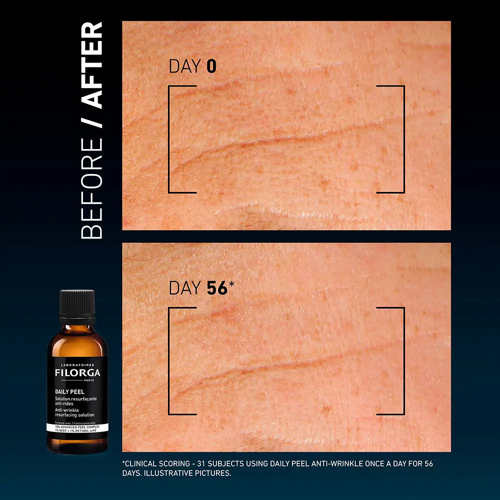 Filorga Daily Peel Solució Antiarrugues 50ml