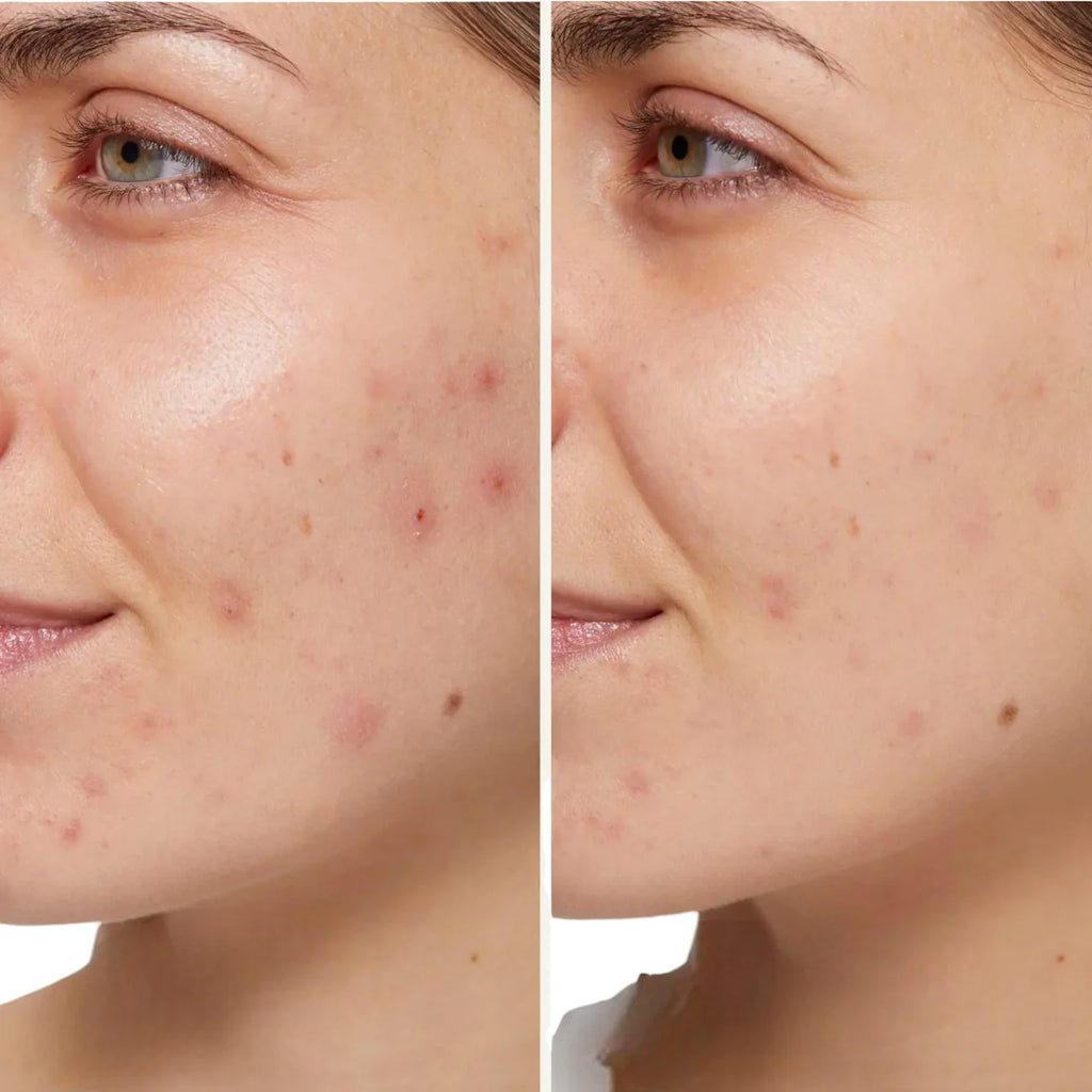 La Rosée Sèrum Purificant 30ml